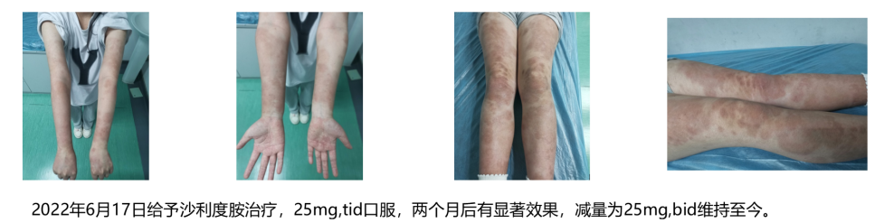 202211161620230252170180197196FD.png?nettype=in&needfile=1&hash=md5:4F:EA:A2:18:35:08:9C:AE:E7:2B:A0:4B:5E:67:0D:35&size=207699&origurl=http%3A%2F%2F10.54.21.89%3A9080%2Fs%2F202211161620230252170180197196FD.png 640 (2).png